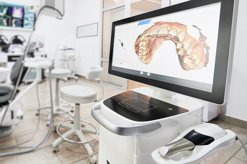 Intra-Oral Scanner in San Luis Obispo