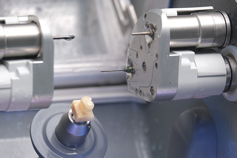In-house dental lab in San Luis Obispo